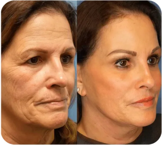 Instant Face Lift Primer