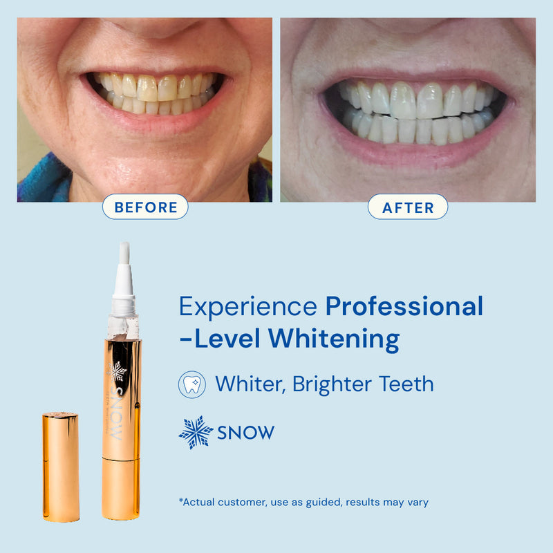 Glowing Teeth Whitening Pen