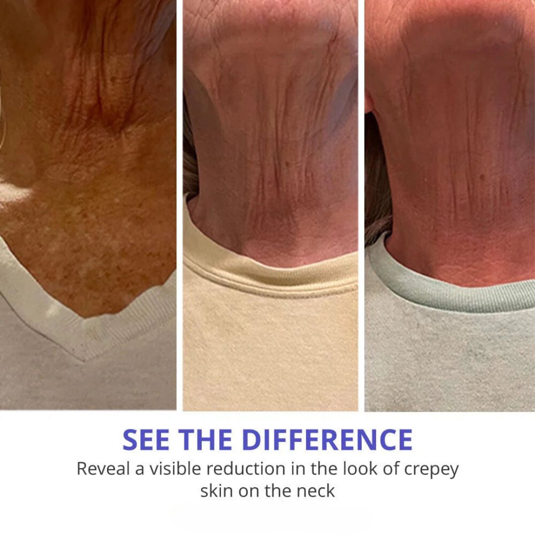 Youthful Neck Tightener