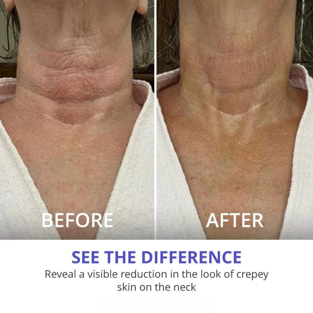 Youthful Neck Tightener
