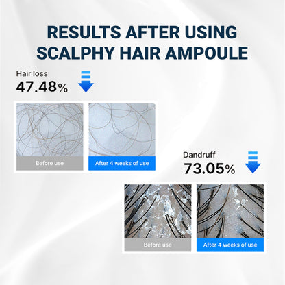 ScalpNourish Hair Serum