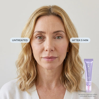 PureLift Instant Eye Gel — 5-Minute Eye Lift
