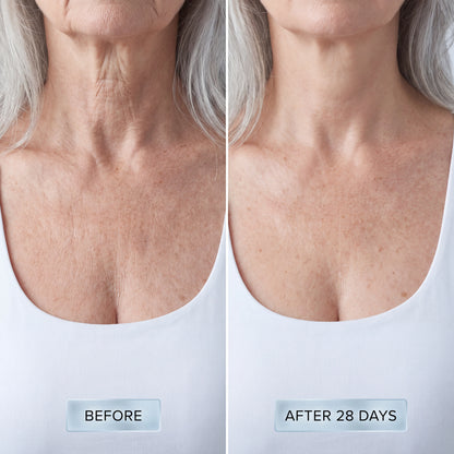 Champagne Lift & Firming Crème Full Set